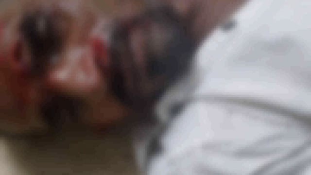 नौबतपुर के नेवा पुल के पास बाइक दुर्घटना में एक युवक का गंभीत रुप से जख्मी