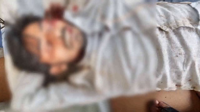 नौबतपुर के पितवास गांव के पास सड़क दुर्घटना में एक युवा गंभीर रूप से जख्मी