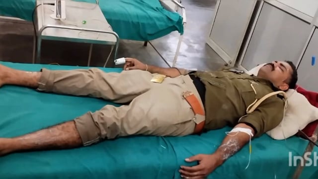 राया में हुई आतिशबाजी की दुर्घटना में फायरमैन हुआ गंभीर रूप से घायल अस्पताल में कराया भर्ती