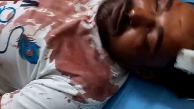 पिनहट में दबंगों ने दलित युवक के साथ लाठी डंडों से जमकर की मारपीट मामूली कहानी में दबंगों ने घर में घुसकर मारा