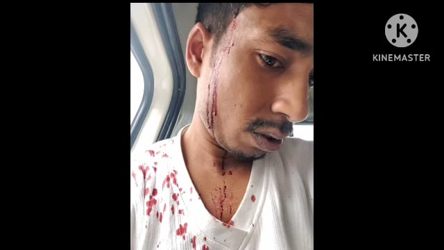 सूरजगढ़ा -बंटवारे को लेकर मारपीट से संबंधित सूरजगढ़ा खाने में दर्ज कराई गई प्राथमिकी।