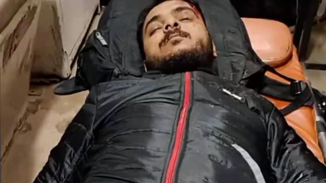 थाना रोजा क्षेत्र मोहम्मदी रोड गांव दिउरिया के पास अज्ञात वाहन की टक्कर लगने से युवक हुआ घायल