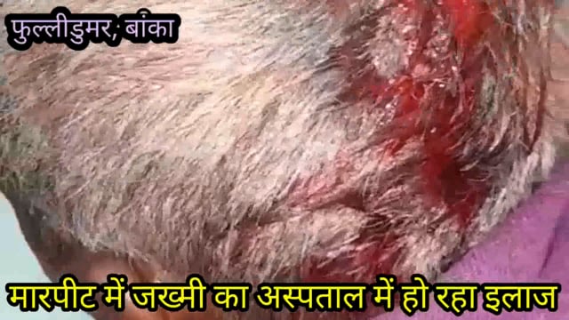 जमीन विवाद में दो पक्षों में हुई जमकर मारपीट, एक पक्ष के तीन लोगों का सर फोड़कर किया लहू- लुहान, ईलाज के बाद बांका रेफर 