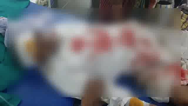 युवा महोत्सव पाहण्यासाठी जाणाऱ्या वृद्धाला दुचाकीची धडक,वृध्द गंभीर जखमी,युवा महोत्सव बनला चर्चेचा विषय