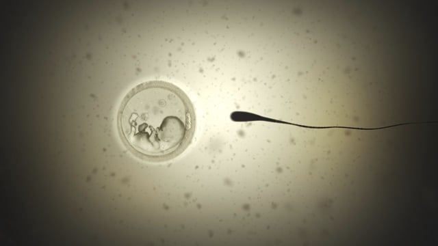 Too Late - Motion Graphics
