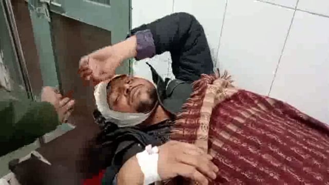 प्रधान की खुली गुंडई दरवाजा लगाने के विवाद के चलते 1 दर्जन दबंगों ने पिता पुत्र पर धारदार हथियारों से बोला हमला नगरपाल ग