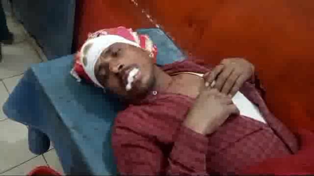 कजरा गांव में खेत में बकरी जाने को लेकर दो पक्षों में हुआ मारपीट कुल सात लोग गंभीर रूप से हुए जख्मी