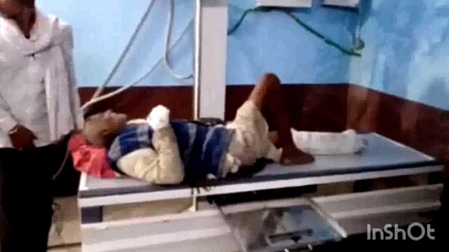 रामगढ़ चौक के बिल्लो ग्राम मे ट्रैक्टर की चपेट में आने से एक वृद्ध व्यक्ति हुए गंभीर रूप से घायल।