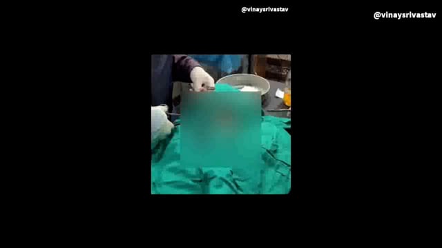 कोपागंज के वाजीदपुरा मोहल्ले में हुई चाकू बाजी हालत गंभीर होने पर जिला अस्पताल किया गया रेफर पुलिस मौके पर