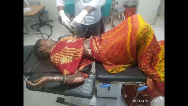खाना बनाने के दौरान लगी आग से 20 वर्षीय महिला झुलसकर हुई बुरी तरह जख्मी, प्राथमिक उपचार के बाद किया गया रेफर 
