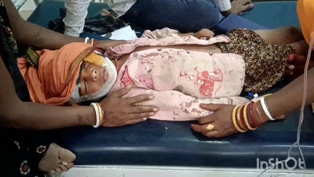 लखीसराय जिले के हलसी थाना क्षेत्र के हलसी गांव में साइकिल से गिरकर 7 वर्षीय बालक गंभीर रूप से जख्मी किया गया उपचार।