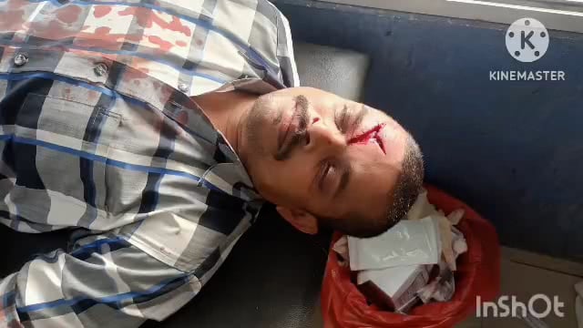 सूर्यगढ़ा -मोटरसाइकिल और साइकिल की जोरदार टक्कर में दोनों व्यक्ति घायल दोनों को इलाज के बाद रेफर किया गया सदर लखीसराय।