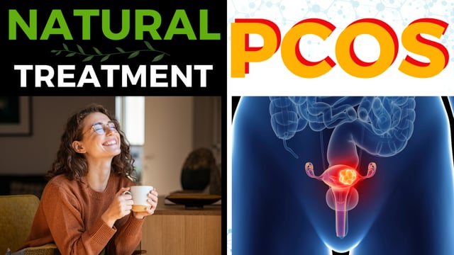 Natural Treatment of Polycystic Ovary Syndrome