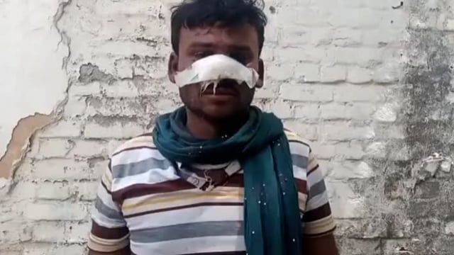 ईको सवार बदमाशों ने सवारी को नशीला पदार्थ सुंघाकर लूटपाट कर सड़क किनारे फेंका,पीड़ित ने पुलिस से की शिकायत 