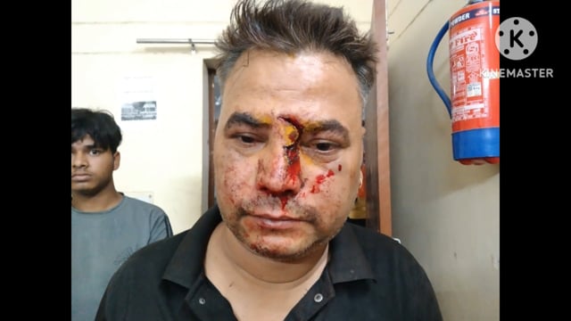 जमीन विवाद को लेकर दो पक्षों में झगड़ा जमकर चले लाठी और डंडे कुल्हाड़ी पथराव आधा दर्जन लोग घायल थे