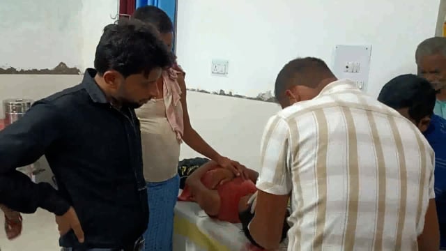 रास्ता विवाद में 20 वर्षीय युवक को लाठी से मारकर सर फोड़ा, प्राथमिक उपचार के बाद गंभीर स्थिति में किया गया रेफर 
