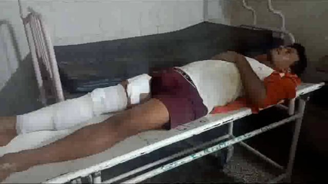 सड़क दुर्घटना में अज्ञात वाहन की चपेट में आने से बाइक सवार घायल, निजी अस्पताल गोंडा में चल रहा इलाज।