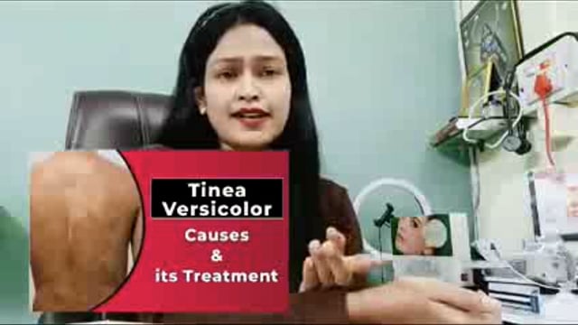 शेरणी रोग क्या है ईसका ईलाज क्या है आईये जानते है डॉ प्रियंका जी के साथ