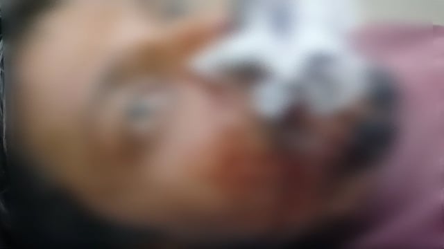 सोहरवा इलाके में पुरानी रंजिश को लेकर दबंगों ने युवक पर किया जानलेवा हमला गंभीर हालत में पहुंचाया गया अस्पताल